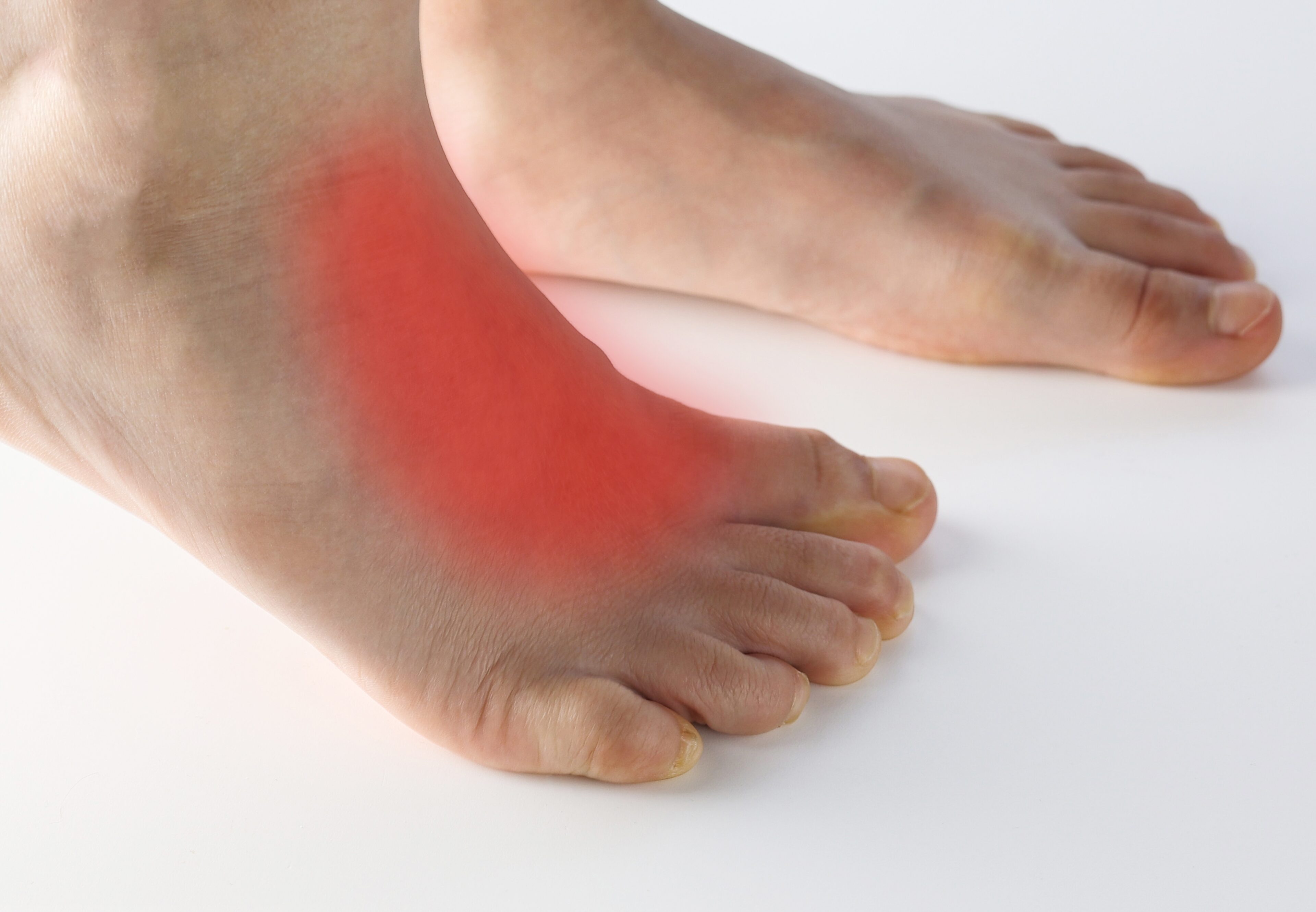 red area to point of pain on top of foot